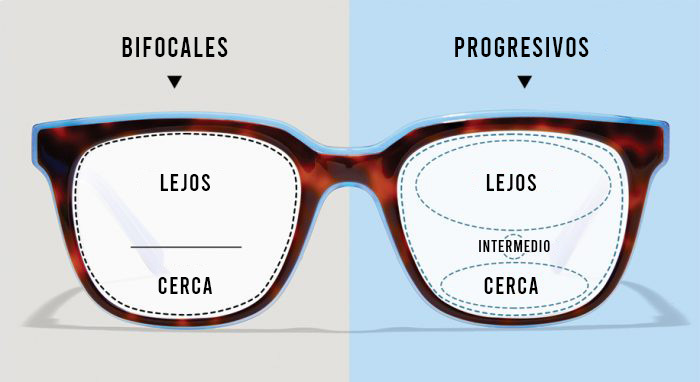 Diferentes tipos de lentes y corrección visual